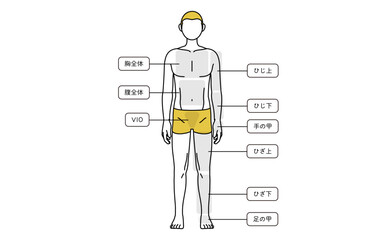 メンズ脱毛、全身（前）の部位案内、下着着用