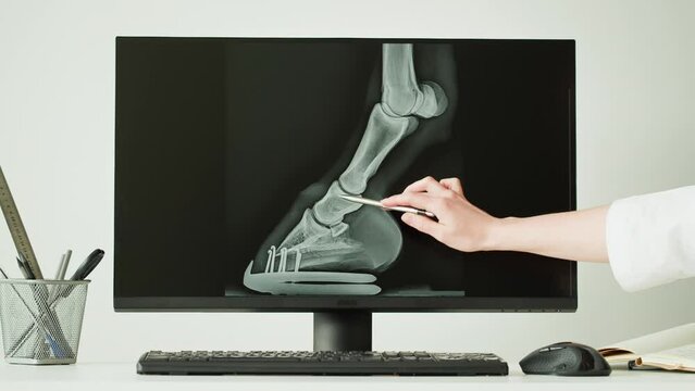 Doctor veterinarian examining horse leg skeleton roentgen on computer monitor. Woman vet analyzing animal bones x-ray, joint close-up. Healthcare and medicine concept.