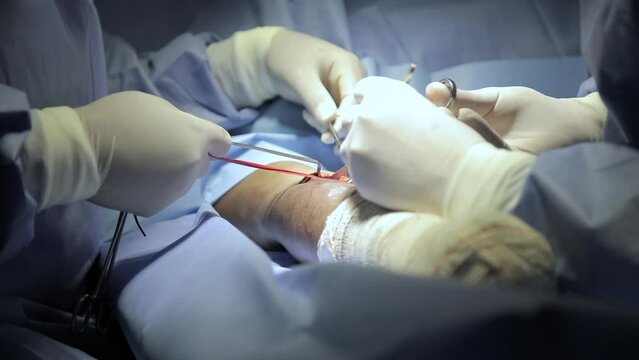 surgical center in procedure fistula for dialysis focus selective and defocused
