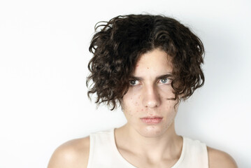 Obraz premium A young teenager boy with a beautiful face but sad because he suffers from acne, he has problems with the health of his facial skin