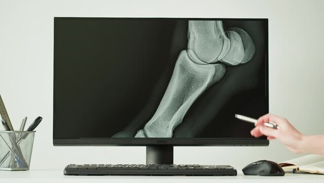 Doctor veterinarian examining horse leg skeleton roentgen on computer monitor. Woman vet analyzing animal bones x-ray, joint close-up. Healthcare and medicine concept.