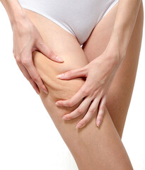 Cellulite skin on woman buttocks - obrazy, fototapety, plakaty