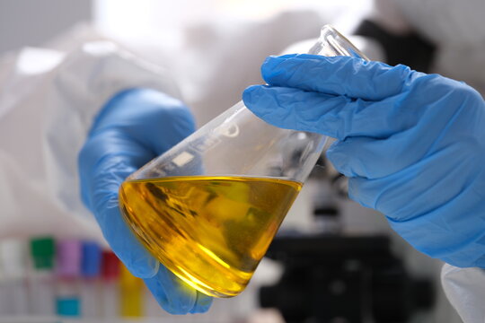 Chemist in gloves holds test tube with yellow oily liquid for research closeup