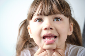 A girl with dental floss wants to pull out a loose tooth. Teeth in two rows. Shark tooth. The permanent incisors grew before the milk teeth fell out.