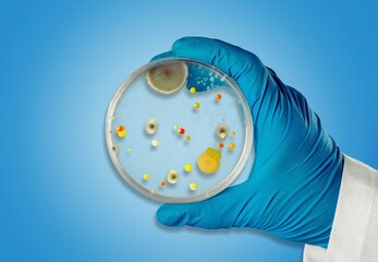 Hand with Petri dish or culture media with bacteria, Test various germs, virus, Coronavirus, COVID-19, Microbial population count, Food science.