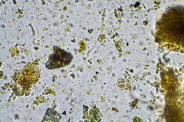 soil microbes organisms in a soil and compost sample, fungus and fungi and under the microscope in regenerative agriculture. in australia.
