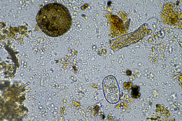 soil microbes organisms in a soil and compost sample, fungus and fungi and under the microscope in...