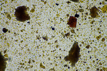 microorganisms living under the microscope