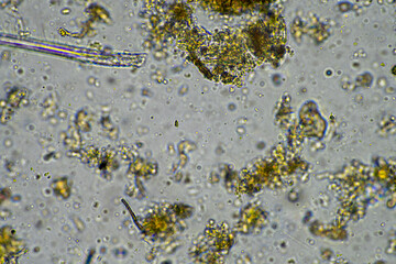 microorganisms living under the microscope