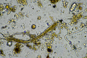microorganisms living under the microscope