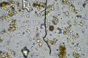 microorganisms living under the microscope