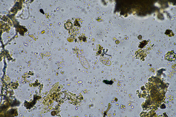 soil microbes in the soil. soil microorganisms tested on a regenerative agricultural farm