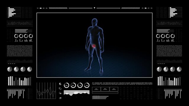 Man with genital pathology. 3d body of boy. Rotating animation and closeup of male human structure.