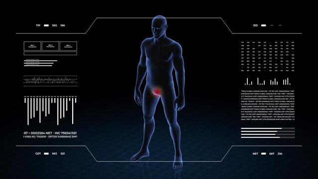 Man with genital pathology. 3d body of boy. Rotating animation and closeup of male human structure.