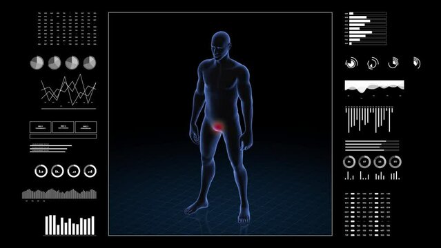 Man with genital pathology. 3d body of boy. Rotating animation and closeup of male human structure.