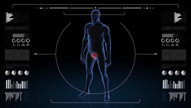 Man with pathology. 3d body of boy. Male human figure.