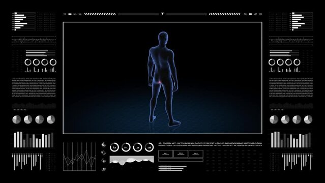 Man with anus pathology. 3d body of boy. Rotating animation and closeup of male human structure.