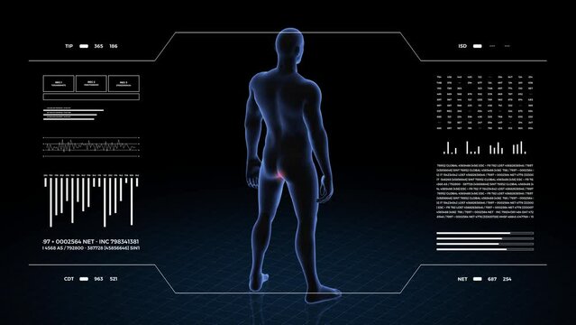 Man with anus pathology. 3d body of boy. Rotating animation and closeup of male human structure.