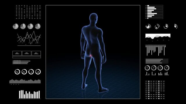 Man with anus pathology. 3d body of boy. Rotating animation and closeup of male human structure.