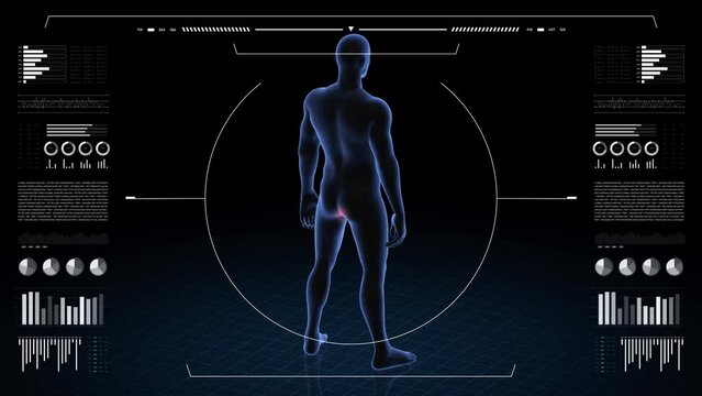 Man with pathology. 3d body of boy. Male human figure.