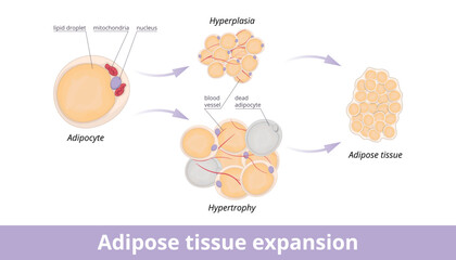 Adipose tissue expansion. Mechanisms of adipose tissue expansion: hypertrophic and hyperplasic adipose. Hypertrophic and hyperplasic fat cells in fat tissue. - obrazy, fototapety, plakaty