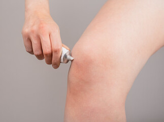 Woman putting pain relieving cream on knee. Leg injury concept. Bruise, sprain, arthritis healing....