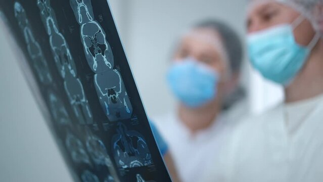 Brains X-ray with blurred professional doctors discussing diagnosis at background. Close-up digital radiographic image in hands of expert Caucasian man and woman talking in hospital