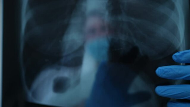 Close-up lungs X-ray image with blurred unrecognizable doctor at background pointing at test result. Caucasian professional radiologist examining roentgen in hospital. Roentgenology concept
