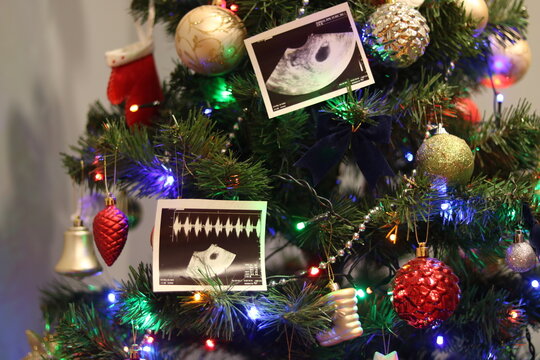Pregnancy ultrasound pictures hanging on the Christmas tree. Christmas time.