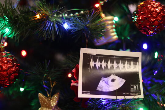 Pregnancy ultrasound pictures hanging on the Christmas tree. Christmas time.