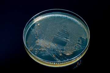 Petri dish with biological samples in a   laboratory of a medical clinic