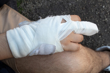A boy with a white splint holding still his broken middle finger
