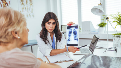 Lung cancer concept. Doctor explaining results of lung check up from x-ray scan chest on digital...