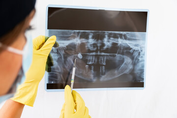 he x-ray is of an old young male female and explains the procedure