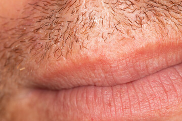 Hair on the skin of a man's face. Macro