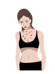 Skin problem, breast acne. Girl with acne 
