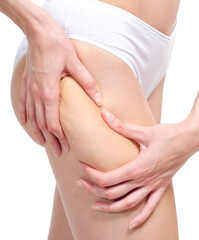 Cellulite skin on woman buttocks