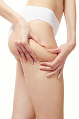 Cellulite skin on woman buttocks