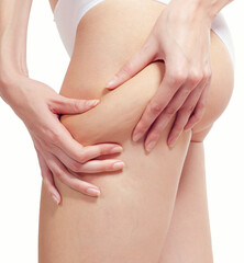 Fototapeta na wymiar Cellulite skin on woman buttocks