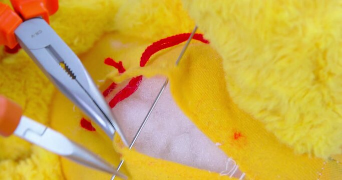 Surgeon sews torn teddy bear with needle and red thread using usual pliers. Doctor tries to cure yellow toy making procedure extreme closeup
