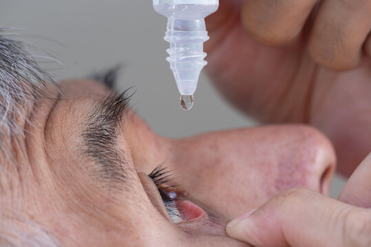 A Senior Asian Man Using Eye Drop In Right Eye