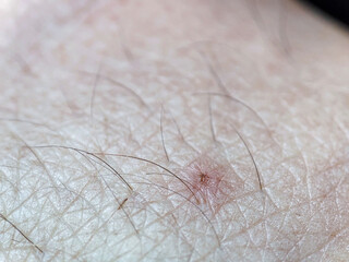 close up of human hand. Macro skin texture. Closeup hand