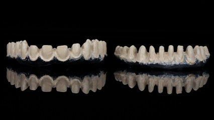 two dental bars made of titanium in a specially applied material for crowns on black glass