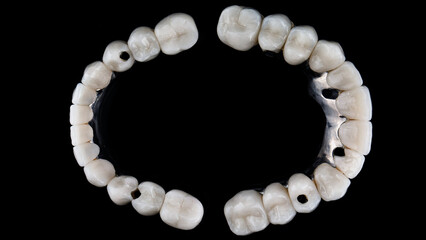 dental composition of two titanium bars and ceramic crowns, top view on a black background