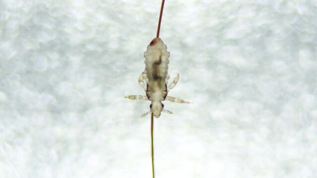 Head louse walking on the human hair. Extreme closeup detail of human parasite. Pediculus capitis. Human infectious disease. Real video.