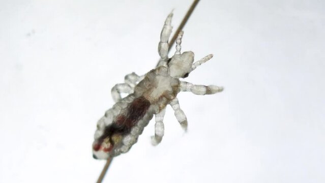 Detail look on head louse on a human hair with movement in her internal organs, and blood inside. Extreme closeup detail of human parasite. Pediculus capitis. Human infectious disease.