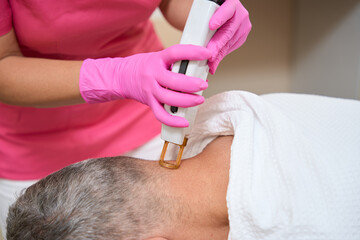 Laser hair removal on back of head of man