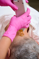 Laser hair removal on the back of the head, close-up