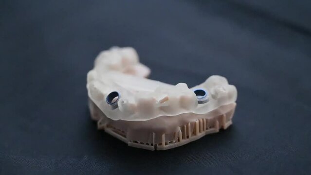 Surgical Guide Implant Systems