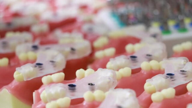 Dental gums